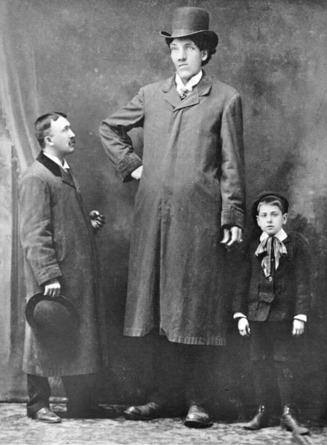 Самые большие люди в мире – как это иметь рост более 2.5 метров?